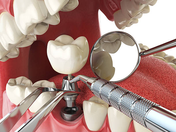 Best Orthodontic Emergency Dentist in Seven Hills, OH