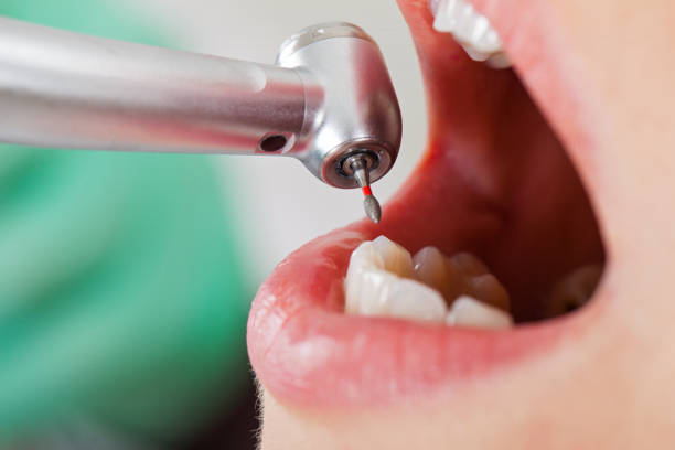 Best Emergency Cosmetic Dentistry in Seven Hills, OH